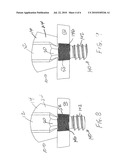 Screw Locking Systems for Bone Plates diagram and image