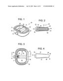 INTERBODY FUSION DEVICE AND METHOD OF OPERATION diagram and image