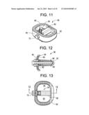 INTERBODY FUSION DEVICE AND METHOD OF OPERATION diagram and image