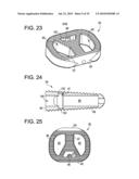 INTERBODY FUSION DEVICE AND METHOD OF OPERATION diagram and image