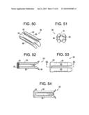 INTERBODY FUSION DEVICE AND METHOD OF OPERATION diagram and image