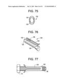 INTERBODY FUSION DEVICE AND METHOD OF OPERATION diagram and image