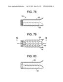 INTERBODY FUSION DEVICE AND METHOD OF OPERATION diagram and image