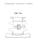 INTERBODY FUSION DEVICE AND METHOD OF OPERATION diagram and image