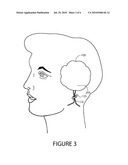 EAR COVER WITH DRAWSTRING AND CONCENTRIC RESILIENT AURAL HELIX HANGER diagram and image