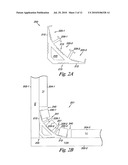 TILED TRANSITION BRACKETING diagram and image