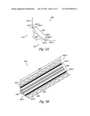 TILED TRANSITION BRACKETING diagram and image