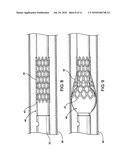 Endotracheal tube cleaning apparatus diagram and image