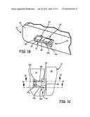 Terminal Platforms for Batteries in Implantable Medical Devices diagram and image