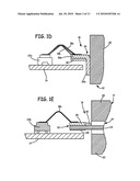 Terminal Platforms for Batteries in Implantable Medical Devices diagram and image