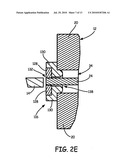 Terminal Platforms for Batteries in Implantable Medical Devices diagram and image