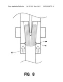 Resin infusion potting diagram and image