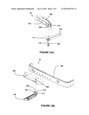 Retractable Peg System diagram and image