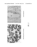 LPAAT-BETA INHIBITORS AND USES THEREOF diagram and image