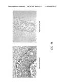 LPAAT-BETA INHIBITORS AND USES THEREOF diagram and image