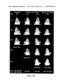METHODS OF TREATING TUMORS IN IMMUNE-PRIVILEGED SITES diagram and image