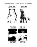 Methods of Rejuvenating Cells In Vitro and In Vivo diagram and image