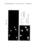 PROGNOSTIC FACTOR IN SARCOMA, AND METASTASIS INHIBITOR diagram and image