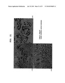 PROGNOSTIC FACTOR IN SARCOMA, AND METASTASIS INHIBITOR diagram and image