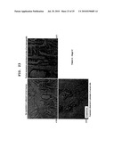 PROGNOSTIC FACTOR IN SARCOMA, AND METASTASIS INHIBITOR diagram and image