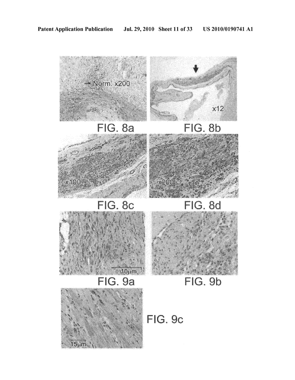 INJECTABLE CROSS-LINKED POLYMERIC PREPARATIONS AND USES THEREOF - diagram, schematic, and image 12