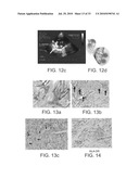 INJECTABLE CROSS-LINKED POLYMERIC PREPARATIONS AND USES THEREOF diagram and image