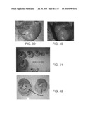 INJECTABLE CROSS-LINKED POLYMERIC PREPARATIONS AND USES THEREOF diagram and image