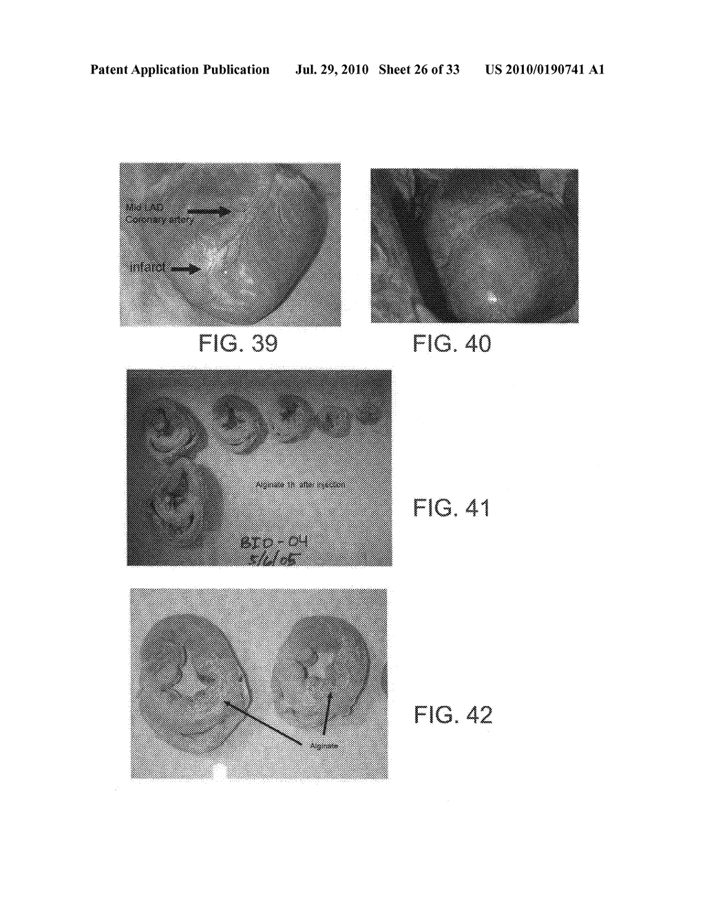 INJECTABLE CROSS-LINKED POLYMERIC PREPARATIONS AND USES THEREOF - diagram, schematic, and image 27