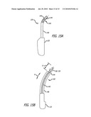Implants And Procedures For Supporting Anatomical Structures diagram and image