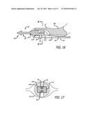Implants And Procedures For Supporting Anatomical Structures diagram and image