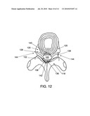 PENETRATING MEMBER WITH DIRECT VISUALIZATION diagram and image