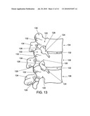 PENETRATING MEMBER WITH DIRECT VISUALIZATION diagram and image