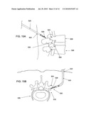 PENETRATING MEMBER WITH DIRECT VISUALIZATION diagram and image