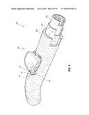 SUBCUTANEOUS VASCULAR ACCESS PORTS AND RELATED SYSTEMS AND METHODS diagram and image