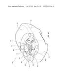 SUBCUTANEOUS VASCULAR ACCESS PORTS AND RELATED SYSTEMS AND METHODS diagram and image