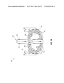 SUBCUTANEOUS VASCULAR ACCESS PORTS AND RELATED SYSTEMS AND METHODS diagram and image