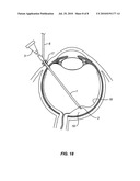 DEVICE FOR ASPIRATING FLUIDS diagram and image