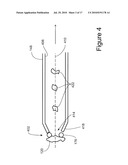 TISSUE REMOVAL DEVICES, SYSTEMS AND METHODS diagram and image