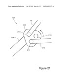 TISSUE REMOVAL DEVICES, SYSTEMS AND METHODS diagram and image