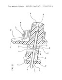 Catheter and Introducer Needle Assembly with Needle Shield diagram and image