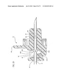 Catheter and Introducer Needle Assembly with Needle Shield diagram and image