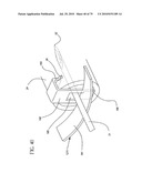 Catheter and Introducer Needle Assembly with Needle Shield diagram and image