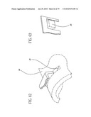 Catheter and Introducer Needle Assembly with Needle Shield diagram and image