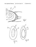 APPARATUS FOR INDIVIDUAL THERAPY PLANNING AND POSITIONALLY ACCURATE MODIFICATION OF AN OPTICAL ELEMENT diagram and image