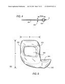 Surgical Guide for use during sinus elevation surgery utilizing the caldwell-luc osteotomy diagram and image