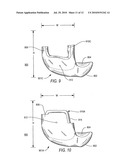 Surgical Guide for use during sinus elevation surgery utilizing the caldwell-luc osteotomy diagram and image