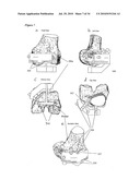 SURGICAL TEMPLATES diagram and image