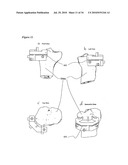 SURGICAL TEMPLATES diagram and image