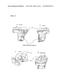 SURGICAL TEMPLATES diagram and image