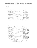 SURGICAL TEMPLATES diagram and image